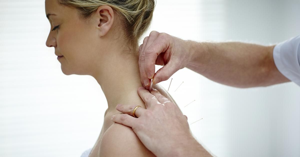Acupuncture : un allié surprenant pour la perte de poids ?
